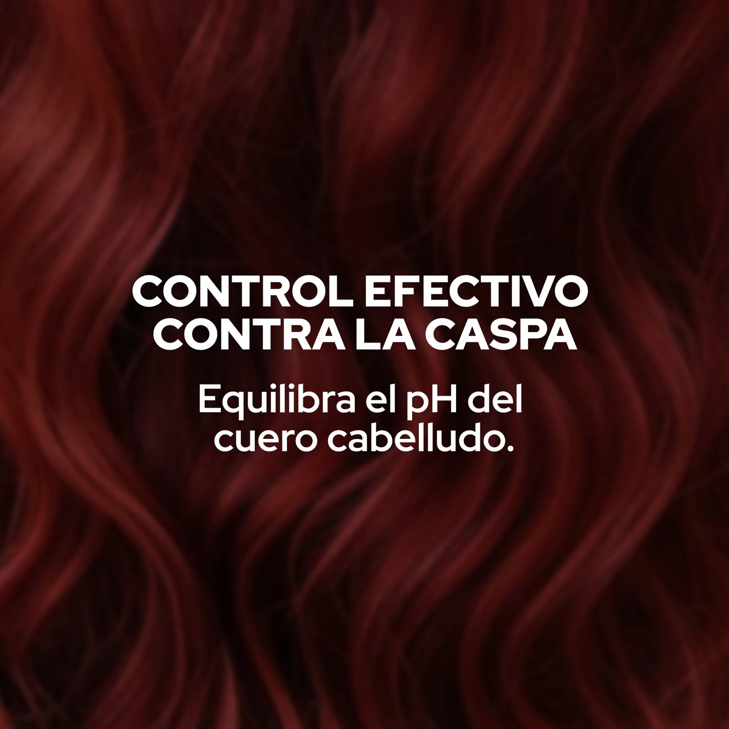 Shampoo Anticaspa ANYELUZ X 400ML